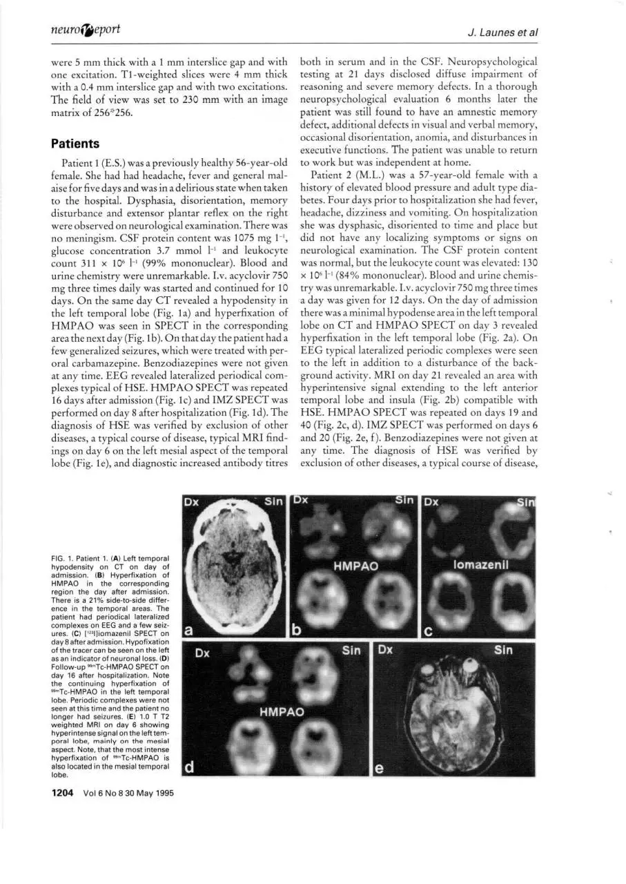 Page 2 of 4, iomazenil