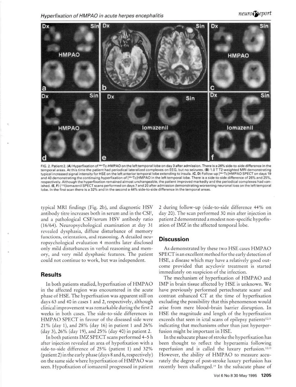 Page 3 of 4, iomazenil