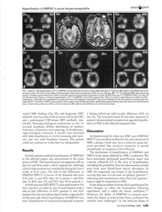 Page 3, iomazenil