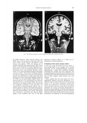 Page 3, isolated retrospective