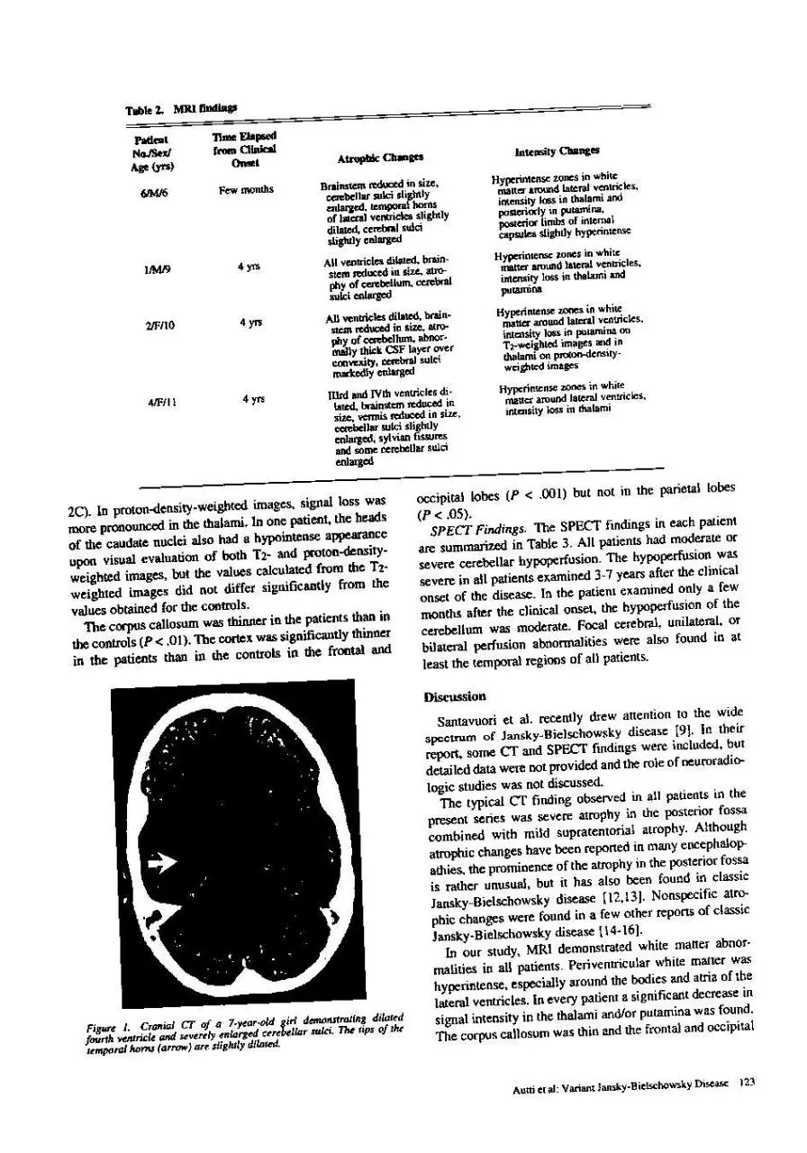 Page 3 of 6, jansky bielschowsky variant