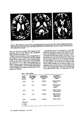 Page 4, jansky bielschowsky variant