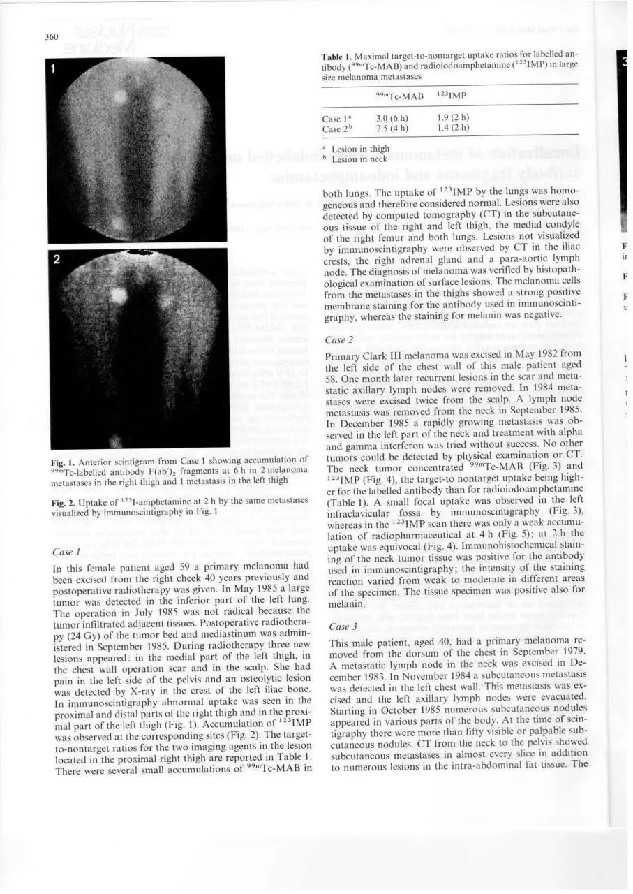 Page 2 of 4, melanoma imp