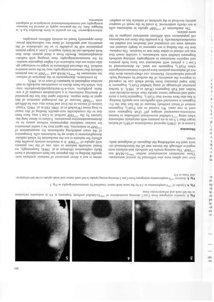 Page 3 of 4, melanoma imp