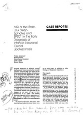Page 1, mri spindles spect incl