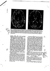 Page 2, mri spindles spect incl