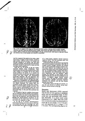 Page 3, mri spindles spect incl
