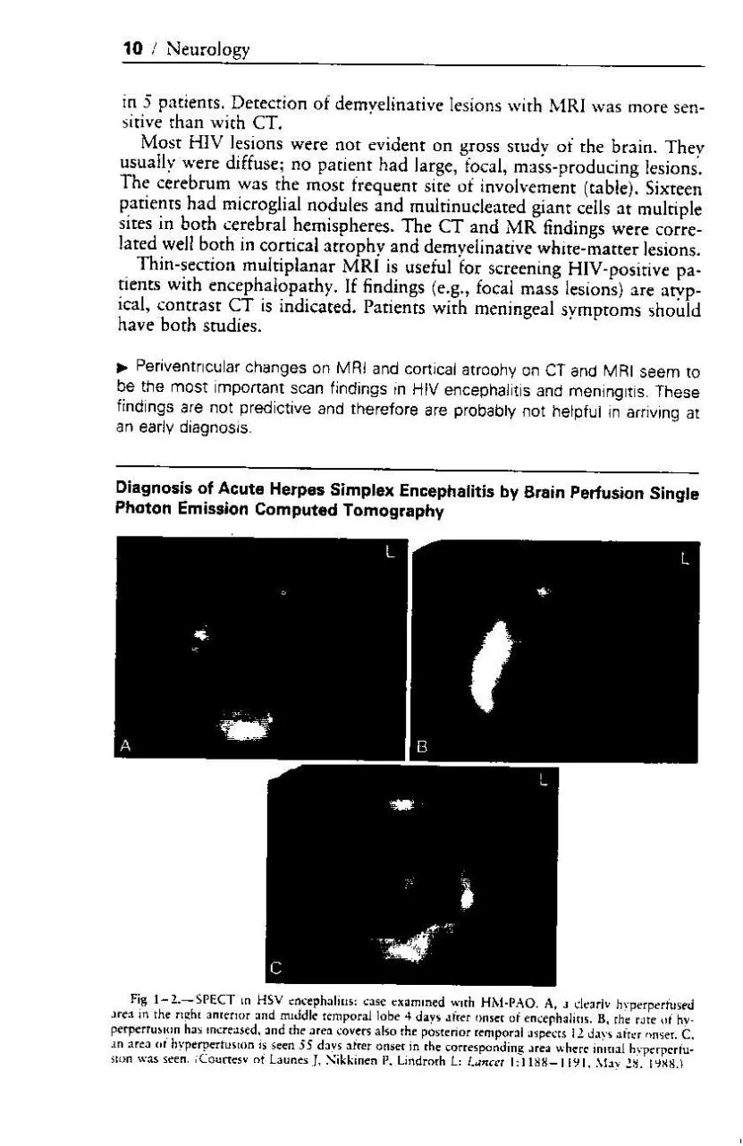 Page 2 of 5, ne encephalitis