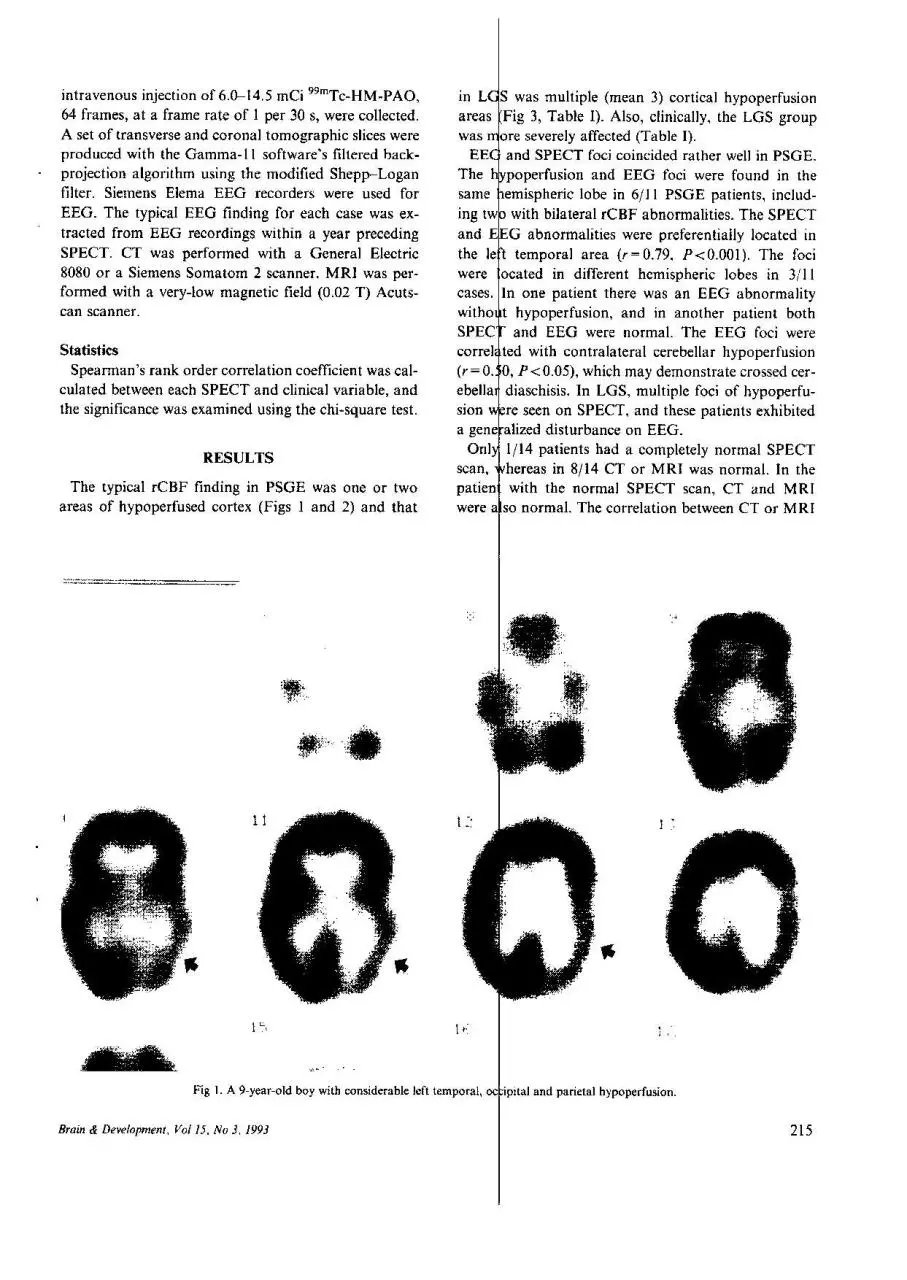 Page 2 of 5, spect in clidren with freq fits