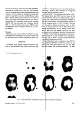 Page 2, spect in clidren with freq fits