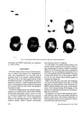 Page 3, spect in clidren with freq fits