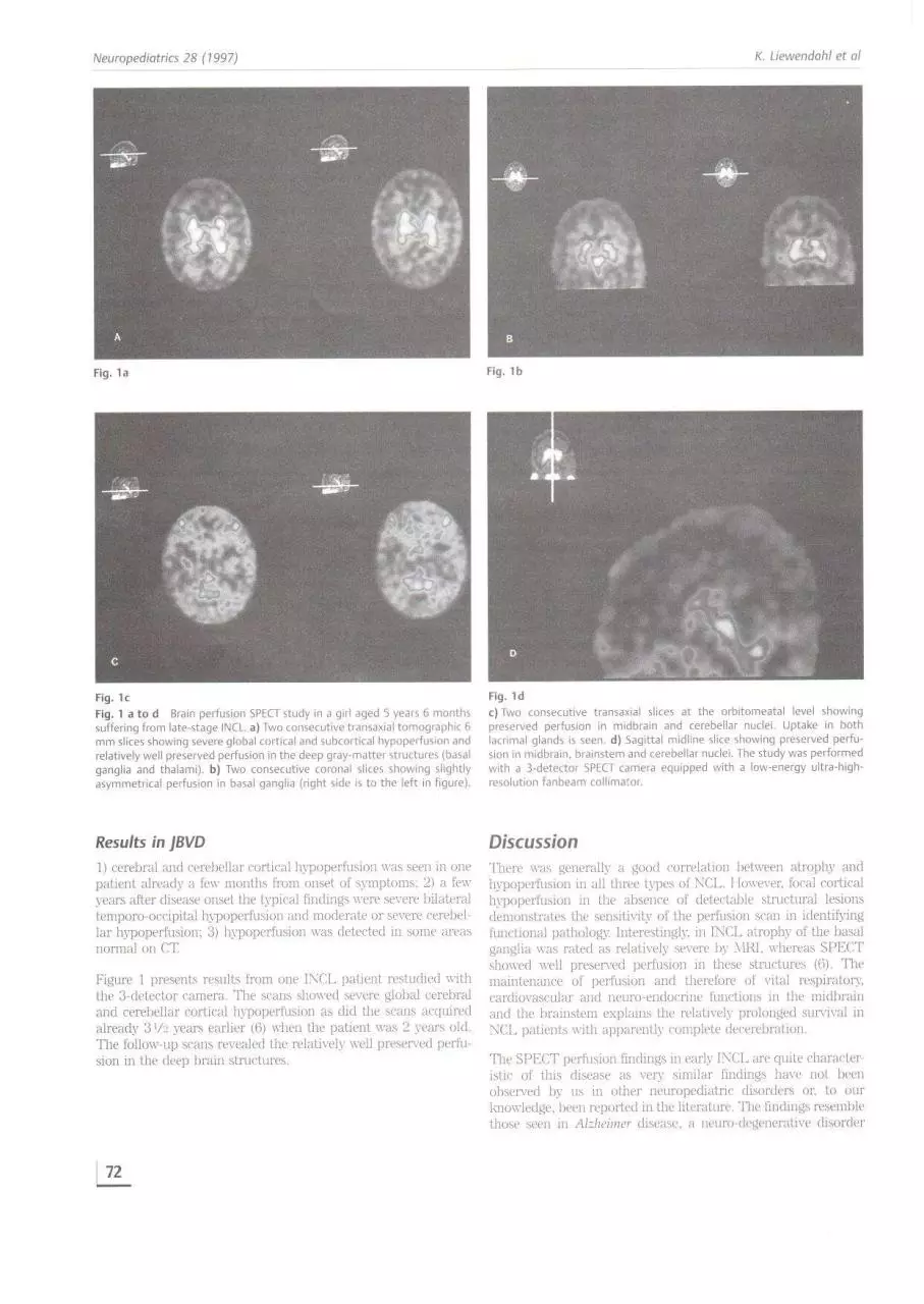 Page 2 of 3, spect in NCL