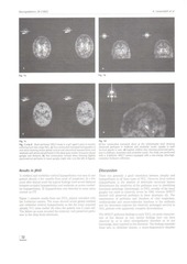 Page 2, spect in NCL