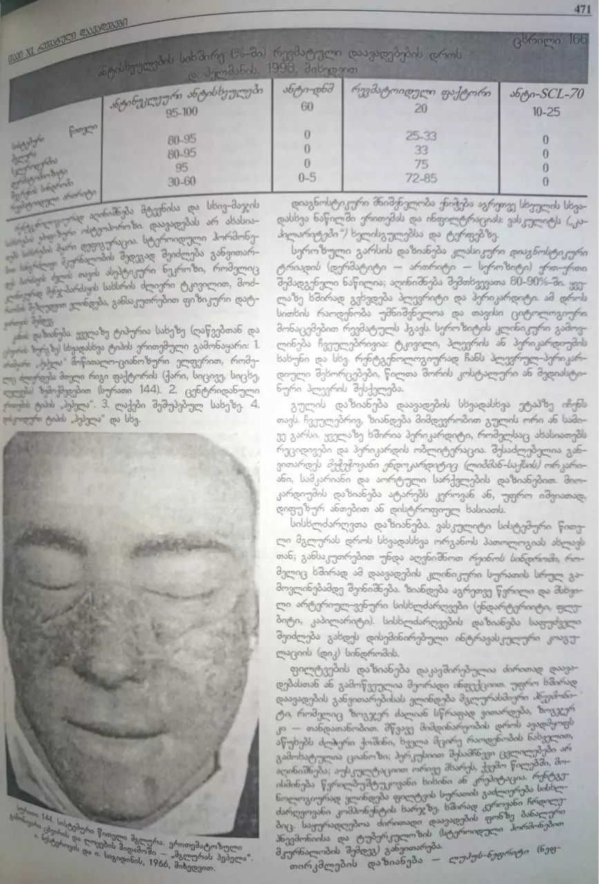 Page 4 of 16, revmatuli daavadebebi p1 tatishvili