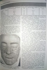 Page 4, revmatuli daavadebebi p1 tatishvili