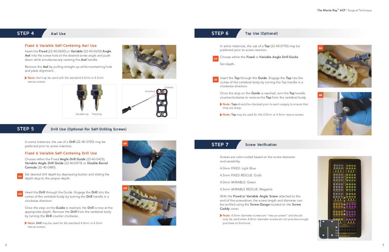15-0247 Manta Ray Surgical Tech_06.pdf - page 4/11