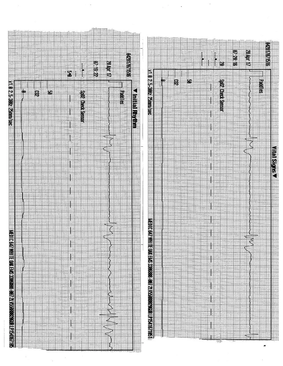 Page 1 of 1, EKG1