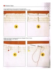 Page 4, Basics of Boutis