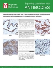 2017dbs antibody flyer 102017 web